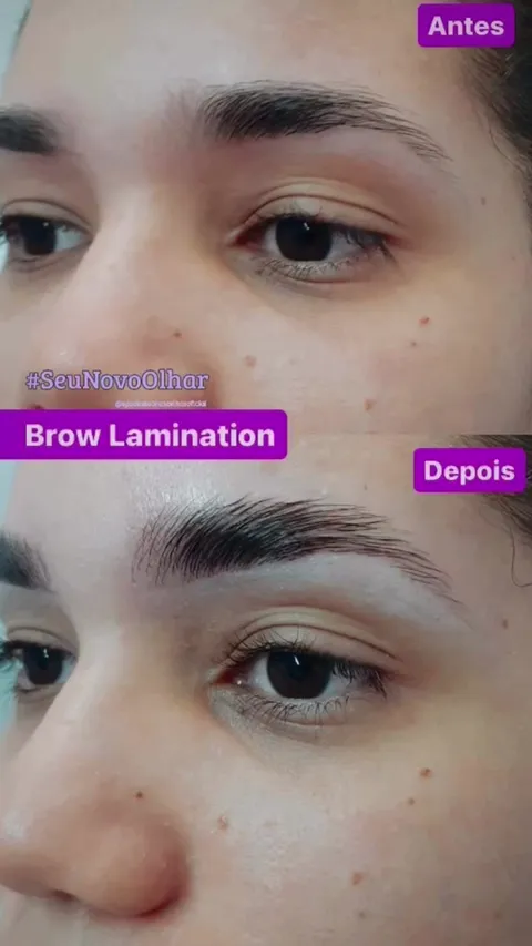 Antes e depois de brow lamination
